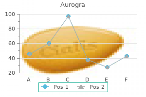 generic aurogra 100mg line