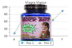 800mg viagra vigour visa